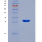 人结蛋白(Des)重组蛋白