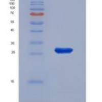 人结蛋白(Des)重组蛋白