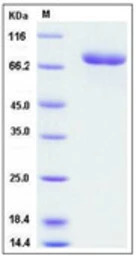Human Transferrin protein, His