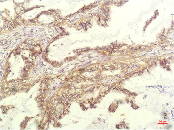 CXCL8 / IL8 antibody [14E1]