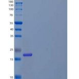 人d-酪氨酰tRNA重组蛋白