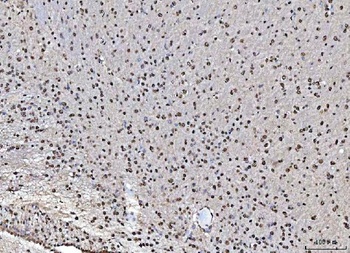 Anti-MATR3 Antibody 抗体，orb1786