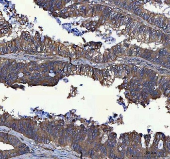 Anti-MSLNL Antibody 抗体，orb1786