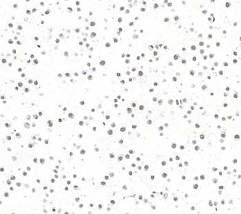 ARID1B Antibody 抗体，orb1806438，