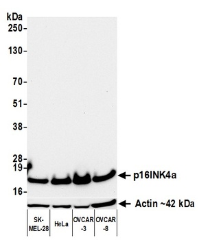 p16INK4a Antibody 抗体，orb180643