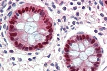 TPD52L2 Antibody 抗体，orb1247626