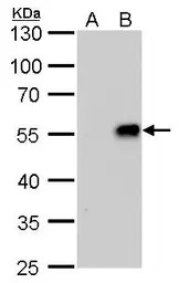 Influenza A virus H1N1 NA (Neu