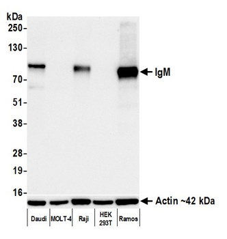 IgM Antibody 抗体，orb1806431，Bio