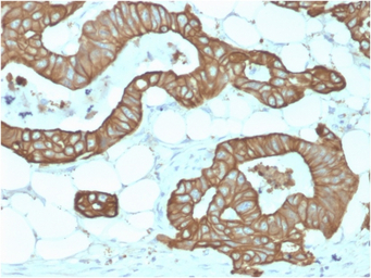 Cytokeratin 19 antibody [KRT19