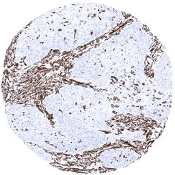 Vimentin antibody [MSVA-458R] 