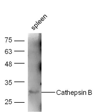 Rabbit Anti-Cathepsin B Polycl