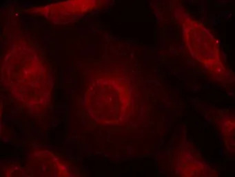 AKT (phospho Tyr315) antibody