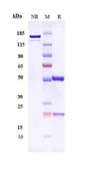 Anti-TPBG Reference Antibody 抗