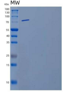 小鼠基质金属蛋白酶9(MMP9)重组蛋白