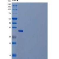 人DCN1样蛋白1/DCUN1D1重组蛋白N-6His