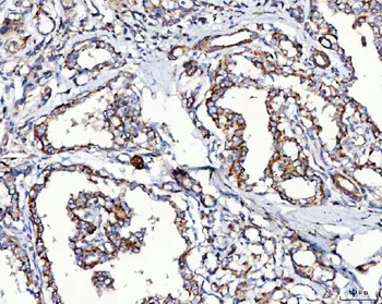 Anti-MCCC2 Antibody 抗体，orb1786
