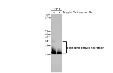 Eosinophil derived neurotoxin 
