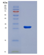 人结蛋白(Des)重组蛋白