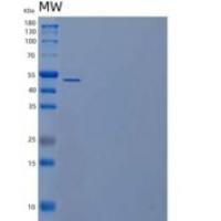 人ADP-核糖精氨酸水解酶/ADPRH/ARH1重组蛋白N-6His