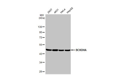 BCKDHA antibody [HL2405]