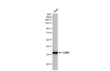 CDK6 antibody [HL2078]