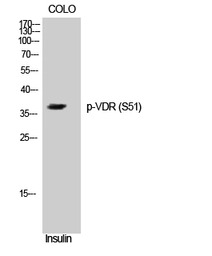 Vitamin D Receptor (phospho Se