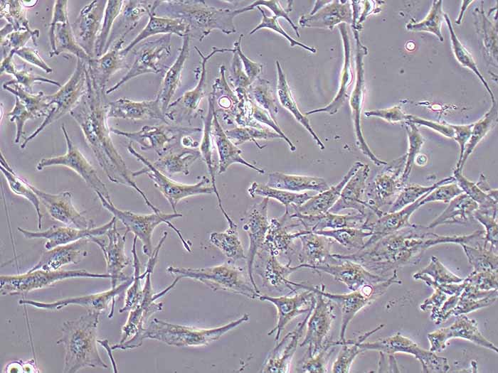 SNB-19人胶质瘤细胞图片