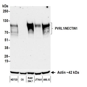 PVRL1/NECTIN1 Antibody 抗体，orb1