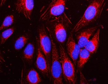 Anti-NAP1L1 Antibody 抗体，orb178