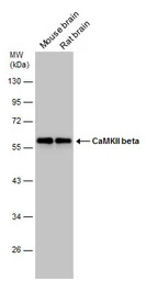 CaMKII beta antibody