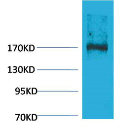 EPG5 antibody