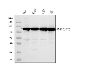 Anti-MPHOSPH10 Antibody 抗体，orb