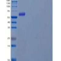 人Vasorin/SLITL2/VASN重组蛋白C-6His