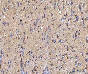 Anti-MOSPD2 Antibody 抗体，orb178