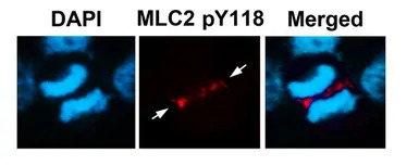 Myosin Light Chain 2 (MLC-2v) 