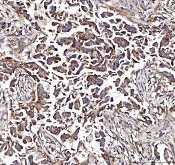 Anti-MCCC2 Antibody 抗体，orb1786