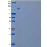 人中间α-球蛋白抑制因子H3(ITIH3)重组蛋白C-6His