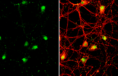 Brachyury antibody [HL2285]