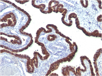 Cytokeratin 7 antibody [OV-TL1