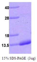 Human S100A4 protein, His tag