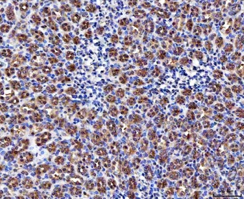 Anti-MCCC1 Antibody 抗体，orb1786