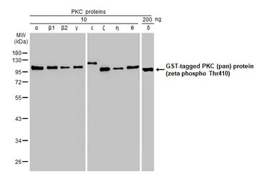 PKC (pan) (zeta phospho Thr410