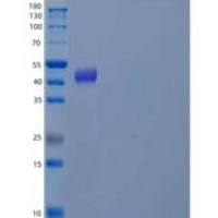 人DNA聚合酶δ亚基2/POLD2重组蛋白C-6His