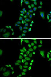 Glyoxalase I antibody