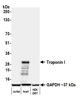 Troponin I Antibody 抗体，orb1806