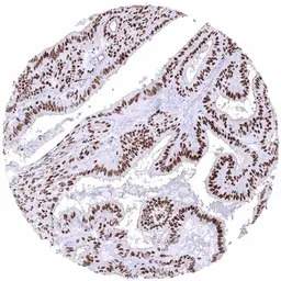 Estrogen Receptor alpha antibo