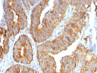 TL1A antibody [VEGI/1283]