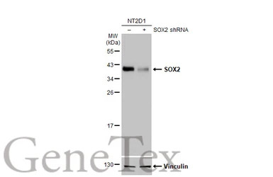 SOX2 antibody [HL1193]