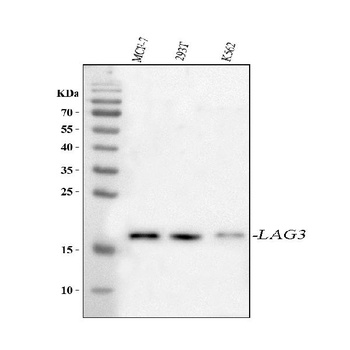 Anti-LAGE3 Antibody 抗体，orb1804