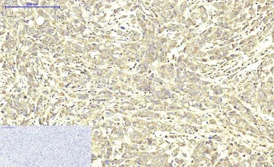 ABCB5 antibody [11A2]